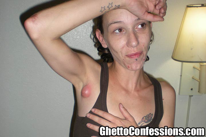 Nasty Ghetto Crack Whore - Crack whore filthy dirty disease - XXX pics